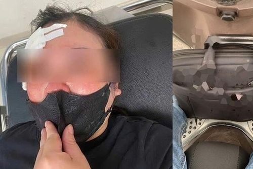 Một phụ nữ bị đánh giữa phố vì dừng xe nghe điện thoại