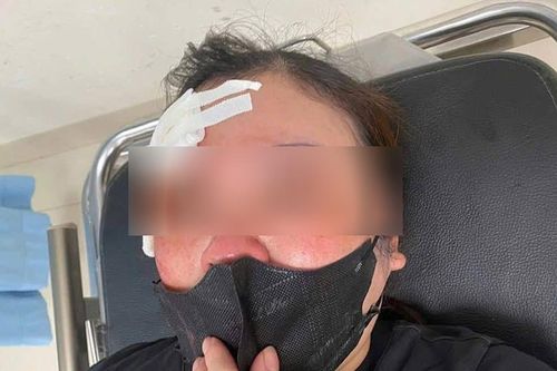 Người đàn ông trên ô tô dùng dùi cui tấn công phụ nữ ở Hà Nội đối diện mức phạt nào?