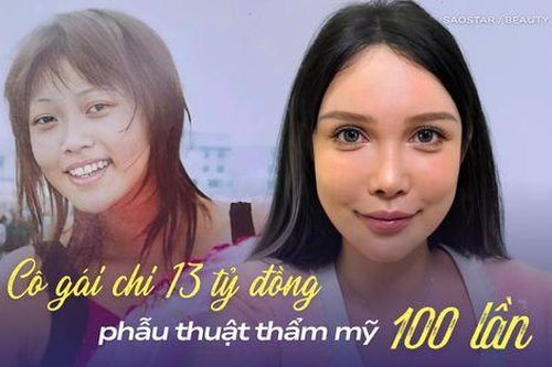 Người phụ nữ chi 13 tỷ đồng phẫu thuật thẩm mỹ 100 lần vẫn chưa thỏa mãn