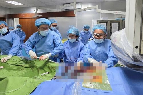 Bệnh viện Thống Nhất thực hiện thành công ca thay van động mạch chủ qua da