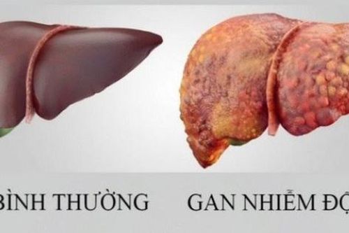 Loại quả mùa hè rẻ tiền, ngọt mát giúp làm mát gan, người Việt dùng vào thời điểm này để giúp gan thải độc