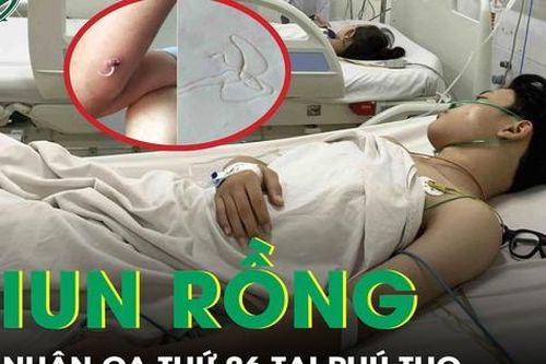 Thêm ca giun rồng thứ 26 ở Phú Thọ