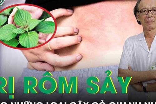 Ngừa rôm sảy mùa hè nhờ cây cỏ vườn nhà – Hiệu quả ít ai ngờ