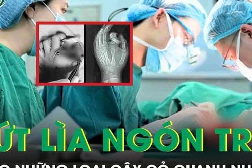 Đứt lìa ngón trỏ khi làm việc, nam công nhân may mắn được nối lại