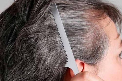 Rụng tóc tuổi già và cách khắc phục