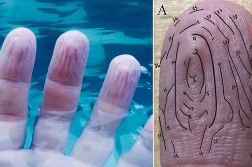 Vì sao ngón tay nhăn nheo khi ngâm nước?