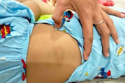 Đình chỉ cơ sở giữ trẻ sau vụ bé gái bị chấn thương 'vùng kín'