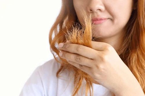 Tóc hư tổn vì chăm sóc sai cách