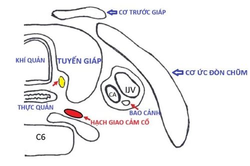 Sụp mi mắt có liên quan đến mổ tuyến giáp?