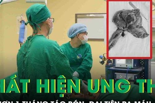 Phát hiện ung thư đại tràng xâm lấn bàng quang sau hơn một tháng táo bón, đại tiện ra máu