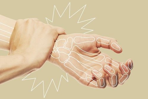 Dấu hiệu cảnh báo xương yếu