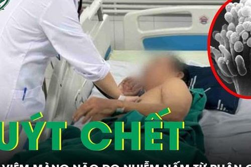 Người đàn ông suýt mất mạng vì viêm màng não do nhiễm nấm từ phân chim
