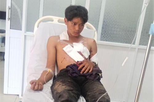 Nổ mìn tự chế khi đi đánh cá, 2 người bị thương nặng