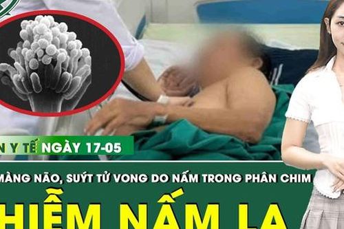 Bản tin Y tế 17/5: Nam bệnh nhân suýt tử vong vì viêm màng não hiếm gặp do nhiễm nấm lạ