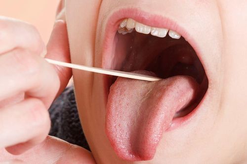 Loét miệng ba tháng không lành, đến viện khám phát hiện ung thư