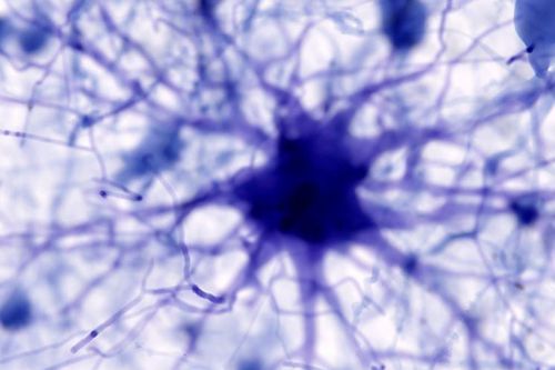 AI phát hiện ra nguyên nhân gây bệnh Alzheimer và có thể tìm ra phương pháp điều trị