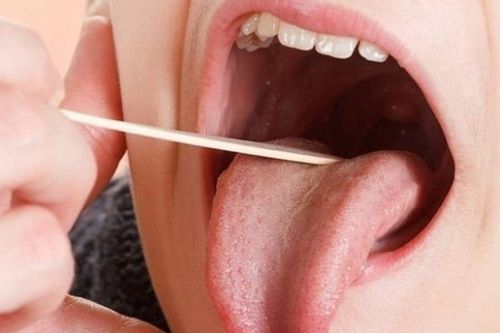 Sau ba tháng điều trị nốt sùi ở miệng nhưng không lành, người đàn ông sững sờ nhận chẩn đoán ung thư