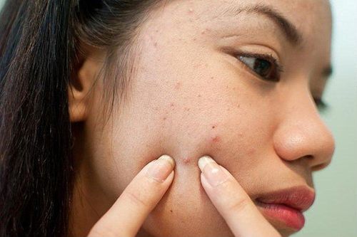 Thói quen sờ tay lên mặt gây hại gì cho làn da?