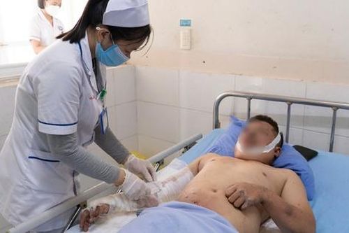Nổ tại nhà máy nam châm ở Quảng Nam, nhiều công nhân nhập viện