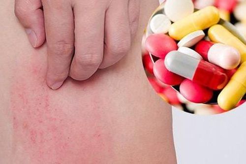 Thuốc dị ứng có an toàn khi dùng mỗi ngày?