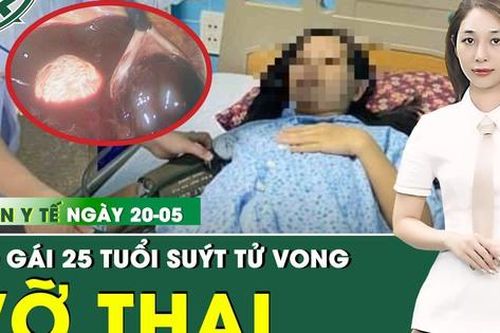 Bản tin Y tế 20/5: Cô gái 25 tuổi suýt tử vong vì vỡ thai ngoài tử cung