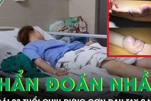 Cô gái 23 tuổi sốc khi phát hiện ung thư sau 9 năm bị chẩn đoán nhầm
