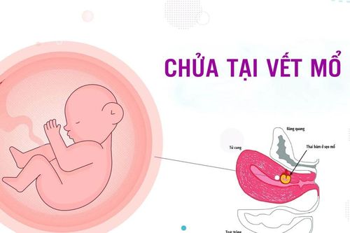 Chửa trên vết mổ cũ, thai vỡ máu tràn ổ bụng nguy kịch