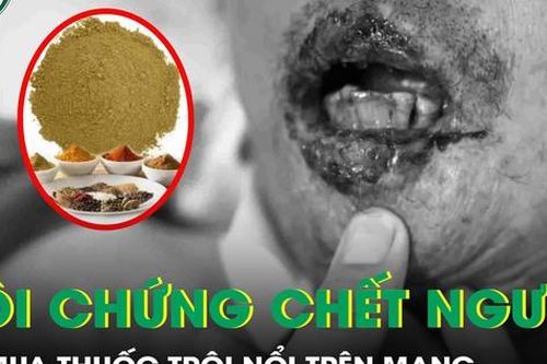 Mua thuốc trôi nổi trên mạng, người đàn ông mắc hội chứng chết người, tiên lượng tử vong cao