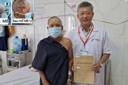 Bệnh viện đa khoa vùng Tây Nguyên phẫu thuật thành công cho bệnh nhân có u khổng lồ ở đầu