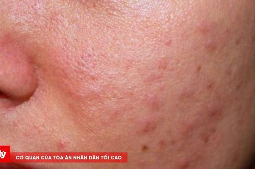 Hệ lụy khôn lường khi mỹ phẩm giả tung hoành thị trường