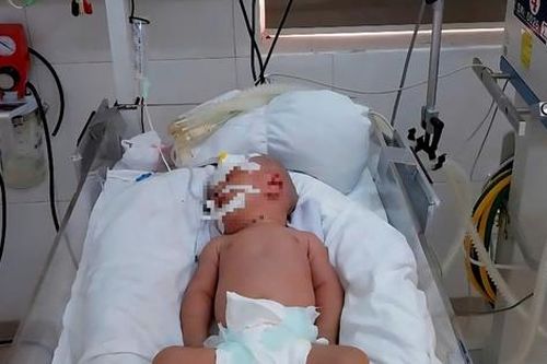Cảnh báo trẻ mắc uốn ván do sinh tại nhà, tự cắt dây rốn