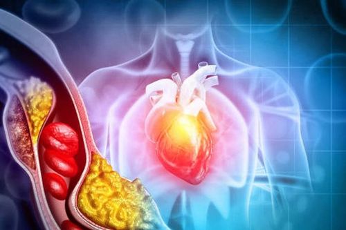7 dấu hiệu cơ thể báo động bạn đang mắc rối loạn mỡ máu