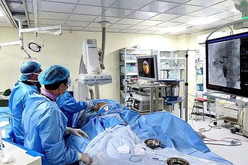 Tán sỏi đường mật qua da dưới hướng dẫn DSA: Mở thêm cơ hội cho bệnh nhân
