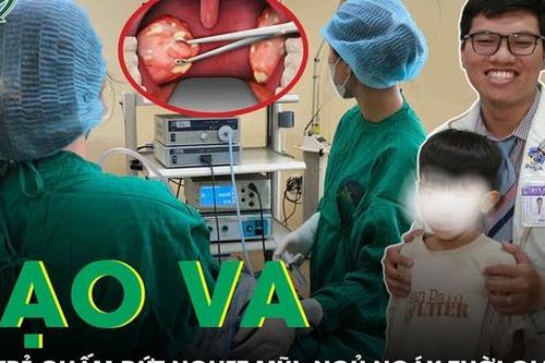 Phẫu thuật nạo VA giúp trẻ chấm dứt nghẹt mũi, ngủ ngáy suốt thời gian dài