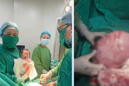 Xử lý thành công khối u xơ tử cung nặng 1,6kg và đón bé trai chào đời