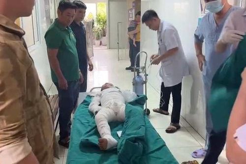 Dùng xăng để đốt kiến, hai anh em bỏng nặng