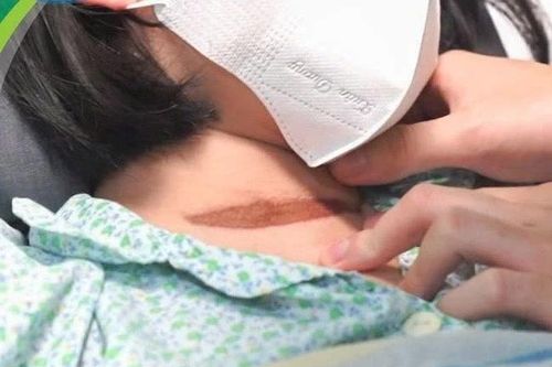 Cứu sống bé gái 11 tuổi bị tai nạn cửa cuốn nguy kịch