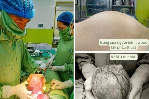 Nhập viện vì uống thực phẩm chức năng... chữa u xơ tử cung