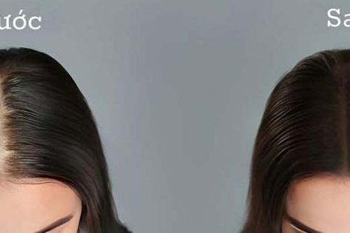 3 cách gội đầu giảm rụng tóc