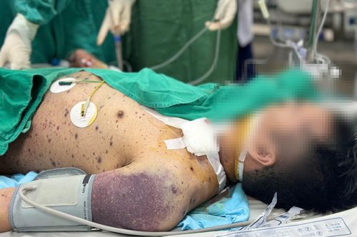 Căn bệnh quen thuộc khiến 2 người khỏe mạnh nguy kịch sau vài ngày