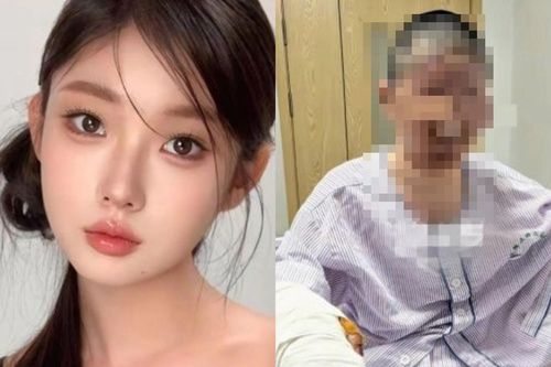 Người mẫu Đồng Dao trước khi bị biến dạng gương mặt