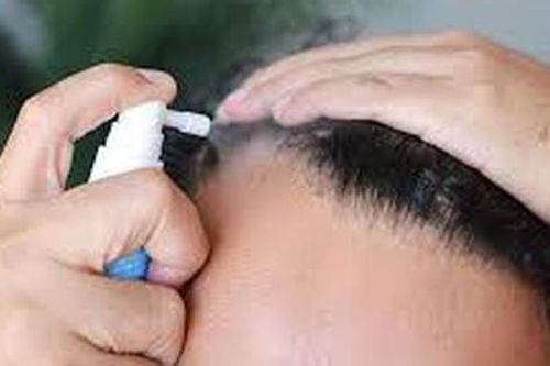 Thuốc điều trị rụng tóc tại chỗ có thể gây rối loạn cương dương, lo âu và sương mù não