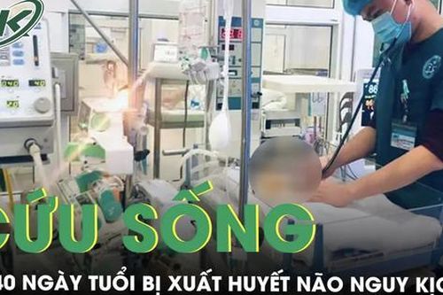 Cứu sống bé 40 ngày tuổi bị xuất huyết não, nguy kịch tính mạng