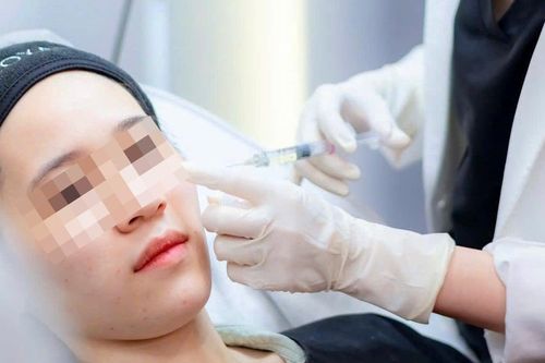 Cách nhận biết filler giả