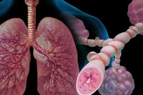 Những lưu ý quan trọng cho người bệnh hen phế quản