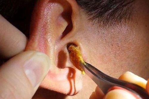 Tại sao chúng ta có ráy tai?