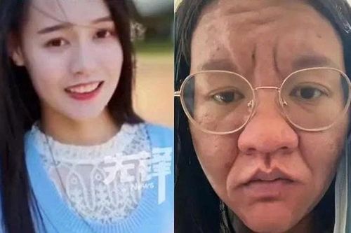Khuôn mặt biến đổi khi mang thai của bà mẹ Trung Quốc gây sửng sốt