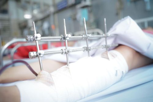 Tình hình sức khỏe của nữ nạn nhân trong vụ sập tường ở Long An