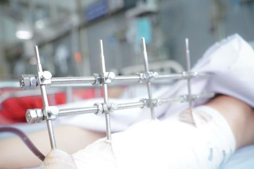 Tình trạng sức khỏe nạn nhân vụ sập nhà do mưa lớn