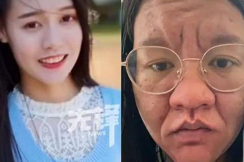 Mặt biến dạng, tóc rụng, da nám: Người mẹ trẻ kể chuyện vượt cạn khiến ai cũng cảm phục